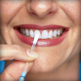 Teeth-whitening-tips